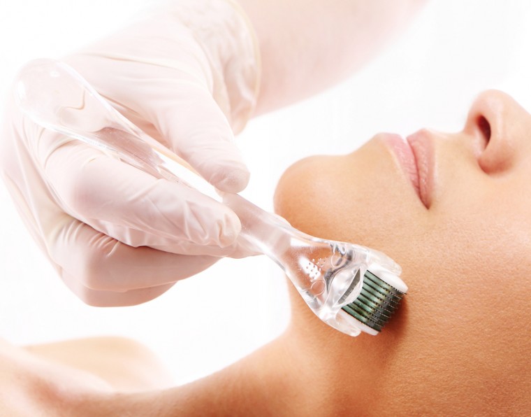 Microagulhamento: conheça a técnica que renova, clareia e rejuvenesce a pele