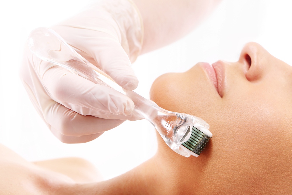 Microagulhamento: conheça a técnica que renova, clareia e rejuvenesce a pele