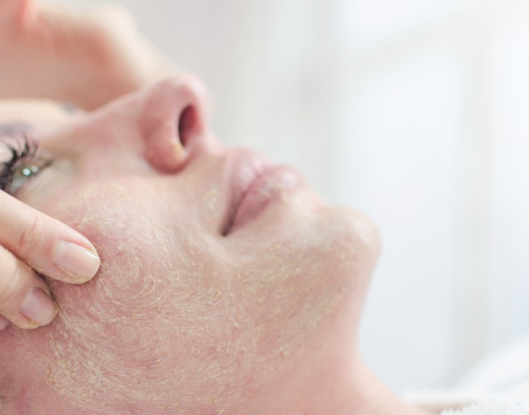 Limpeza de pele pré-peeling: como preparar a pele para melhores resultados | ADCOS Profissional