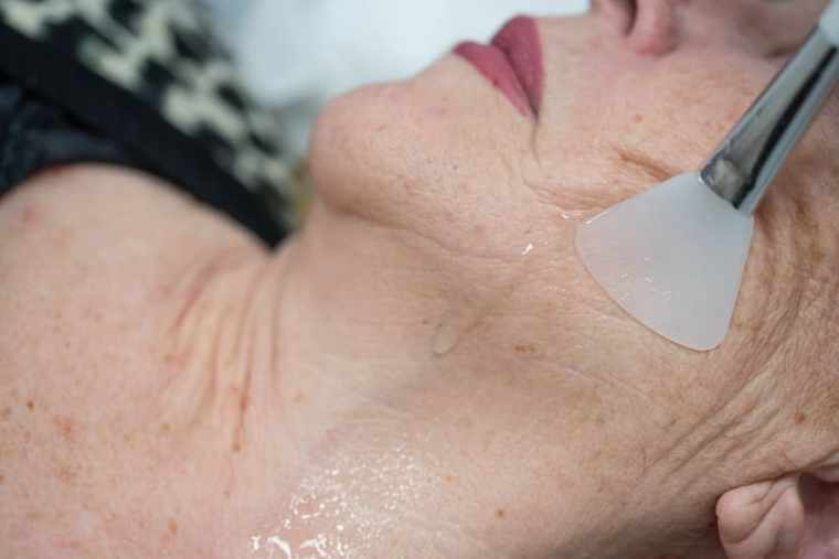 tratamentos anti-idade para pele madura