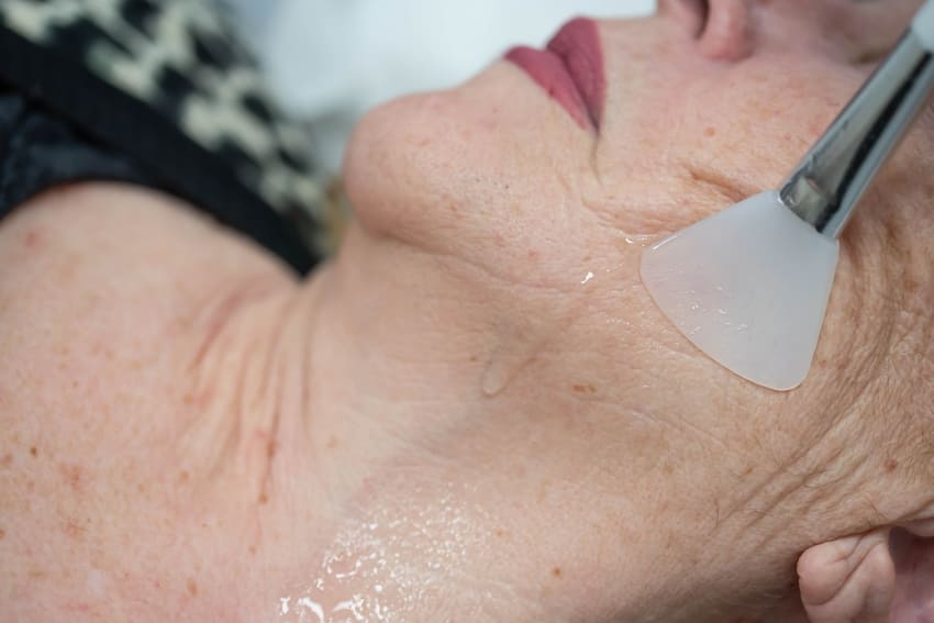 tratamentos anti-idade para pele madura